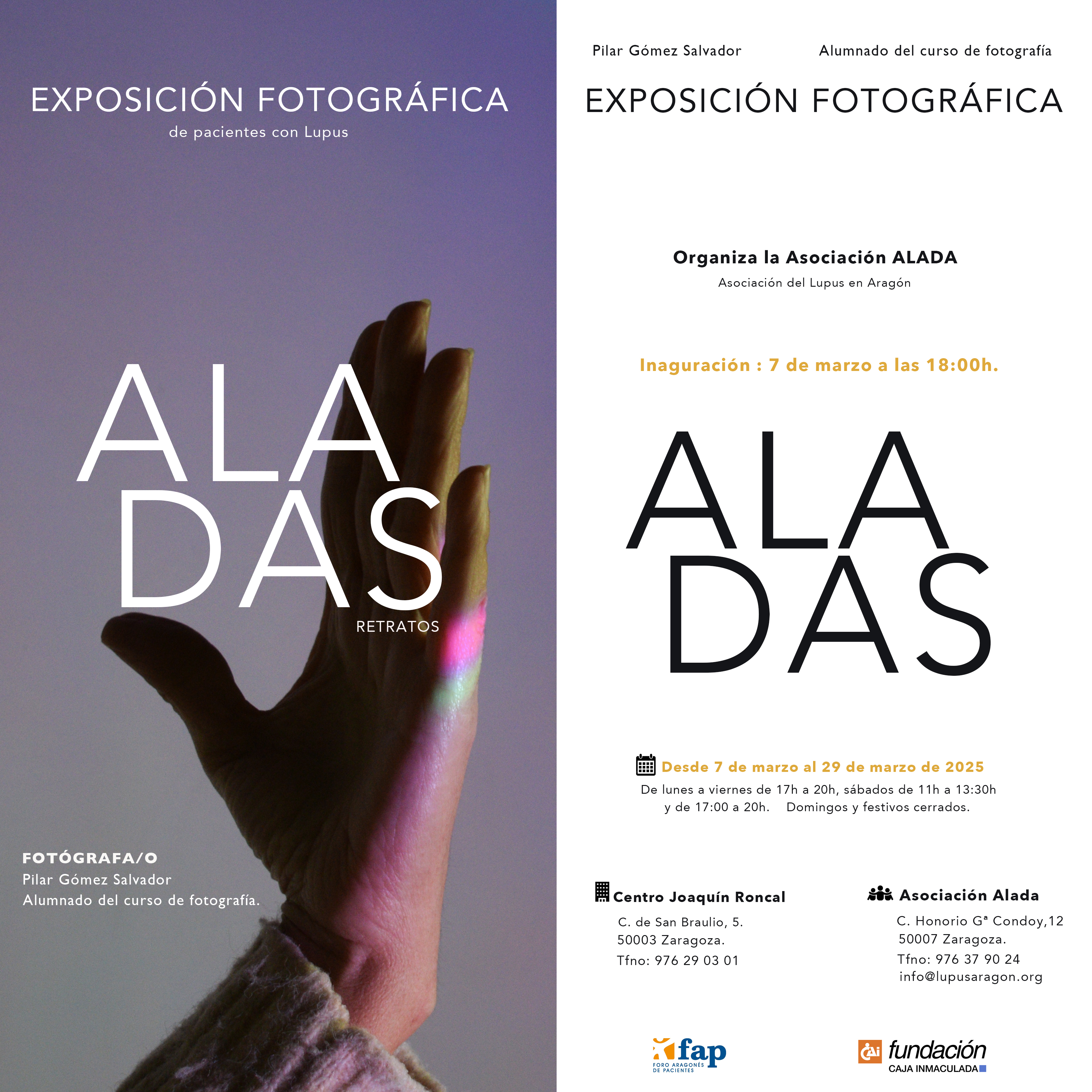 ALADAS Exposición fotográfica sobre la realidad de la enfermedad de LUPUS. Asociación ALADA ARAGÓN